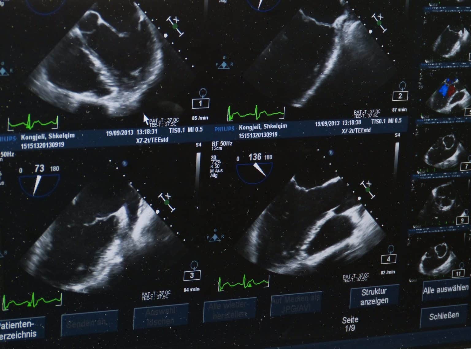 Valence Imaging Ultrasound XRay Clinics Toronto Brampton