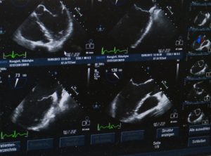 what-you-need-to-know-about-the-prenatal-ultrasound