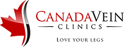 canadian vein clinic ultrasound