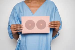 mammography concept