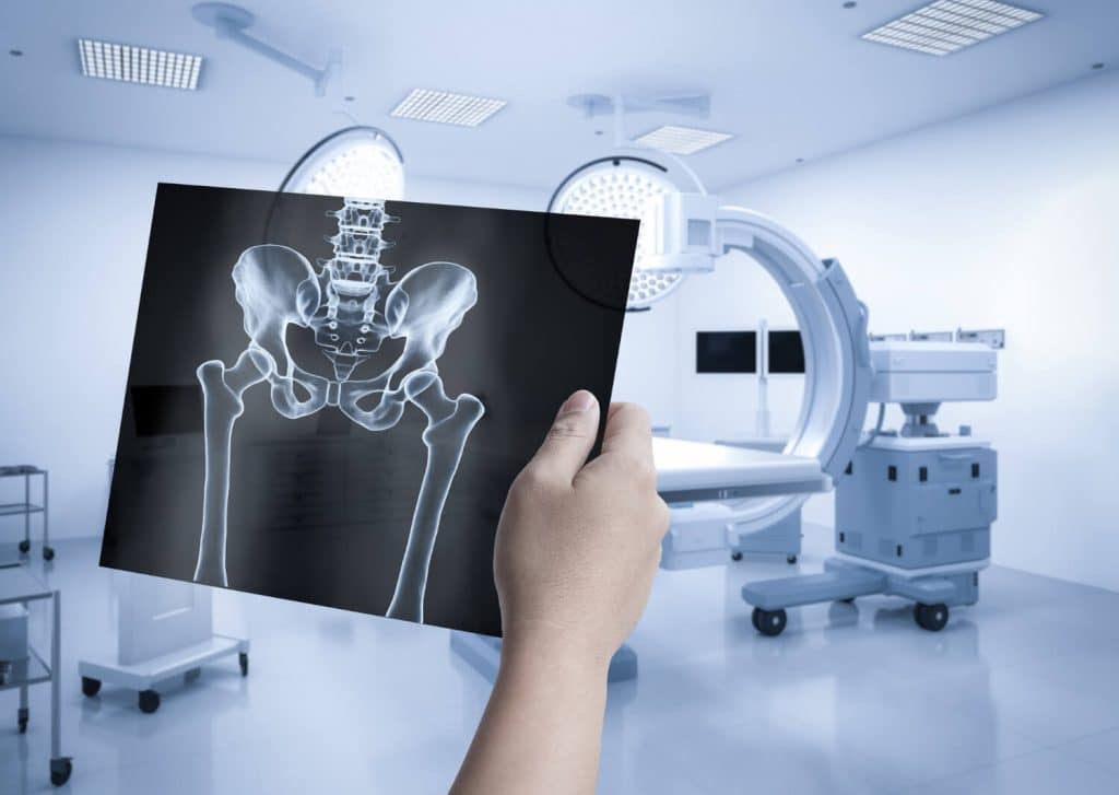 how-x-rays-are-produced
