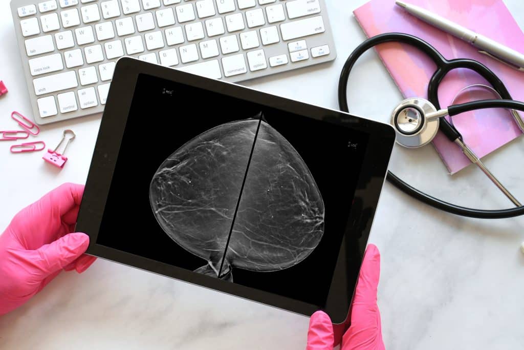 mammogram imaging