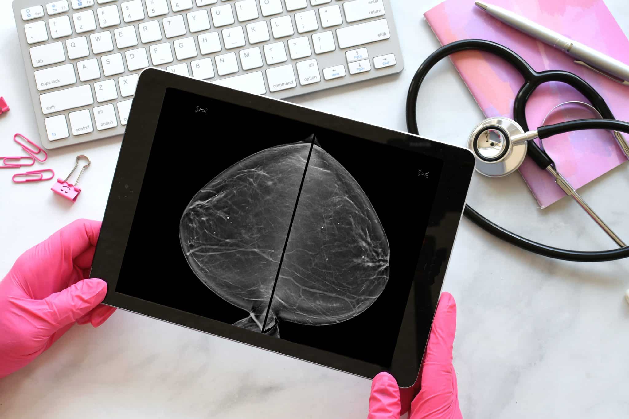 Advancements in Mammogram Image Processing Techniques Valence Medical
