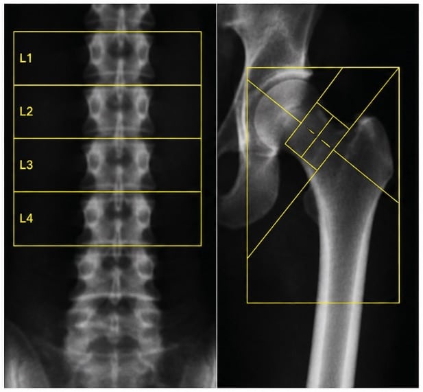 DEXA scan sample